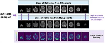 3D-CAM: a novel context-aware feature extraction framework for neurological disease classification